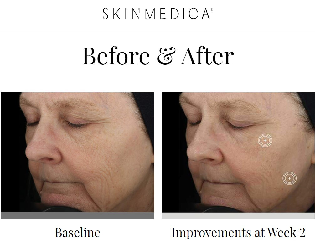 SkinMedica-before-After