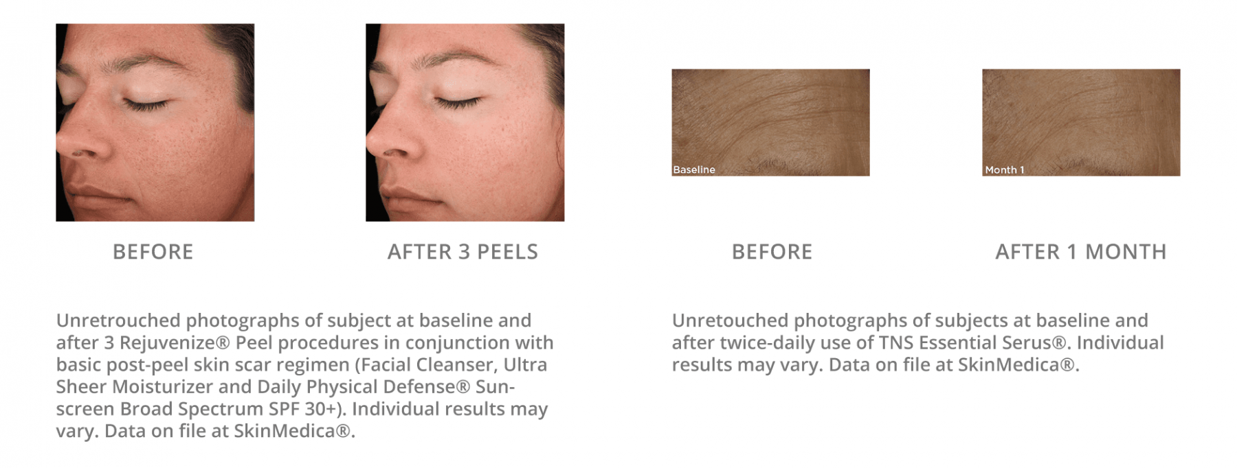 SkinMedica-before-after-3