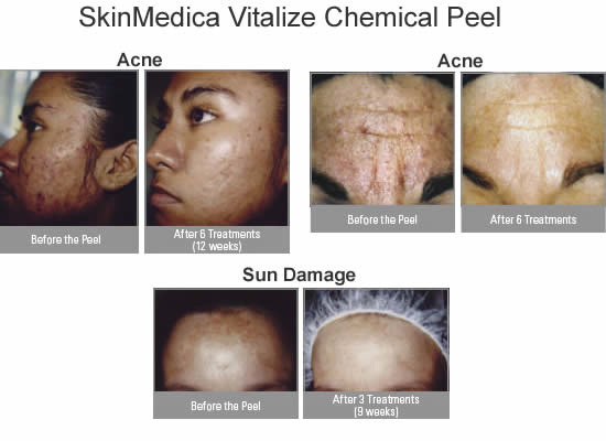 SkinMedica-before-after-4